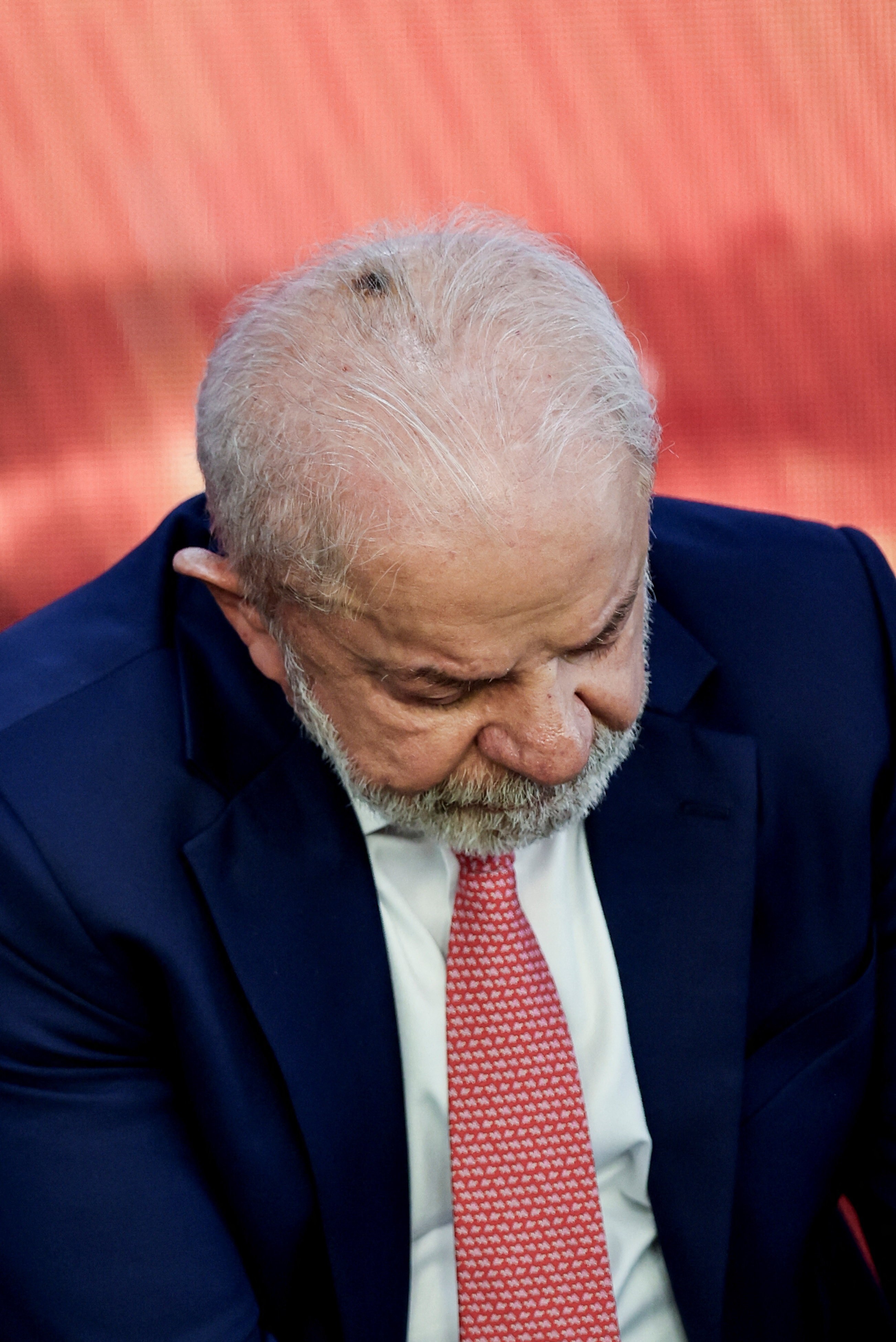Lula Passa por Procedimentos Médicos: O Que Isso Significa?