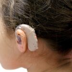 Terapia genética revolucionária para perda auditiva chega aos EUA