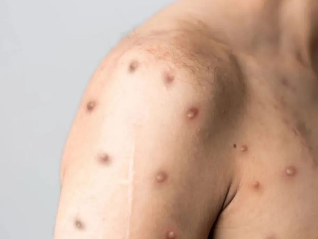 1-midia-de-distribuicao-g1-42-1-1