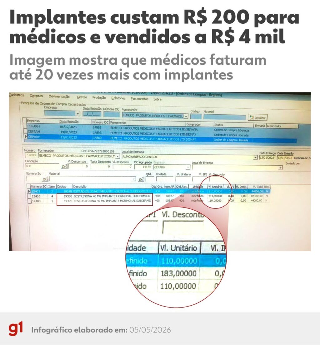 Implantes hormonais: o lado obscuro de um mercado bilionário no Brasil