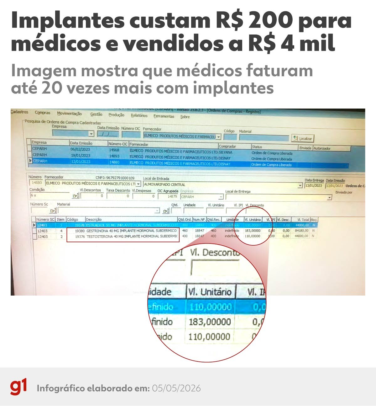 Implantes hormonais: o lado obscuro de um mercado bilionário no Brasil