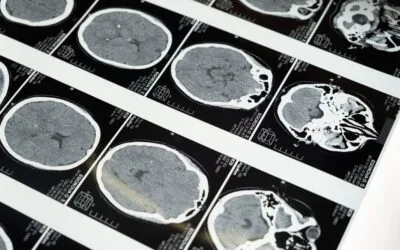 Abdominal não é só estética: ele "limpa" seu cérebro, diz estudo
