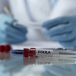 Vacina brasileira contra ebola? Oxford testa nova cepa