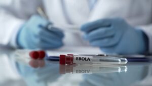 Vacina brasileira contra ebola? Oxford testa nova cepa