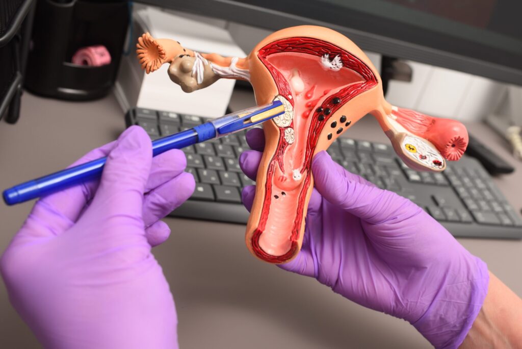 O papel crucial das trompas na fertilidade feminina