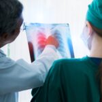 Novo tratamento para câncer de pulmão é aprovado no Brasil